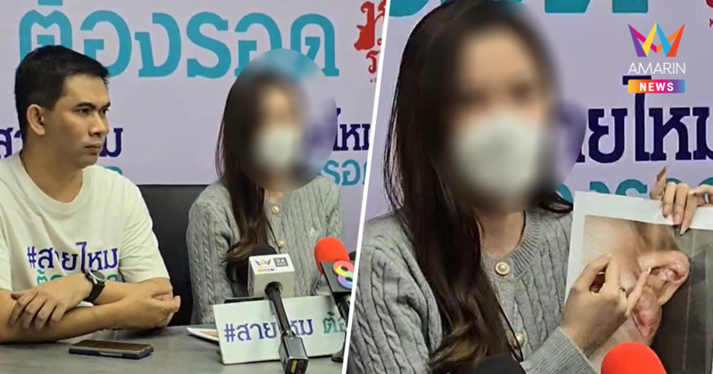 อินฟลูฯสาวสวย ร้องโรงพยาบาลศัลยกรรมชื่อดังกลางกรุงทำจมูกเน่า