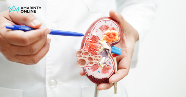 แพทย์เตือนสายนอนดึก-โด๊ปอาหารเสริมประจำ ต้องระวังโรคไตวายเรื้อรัง!