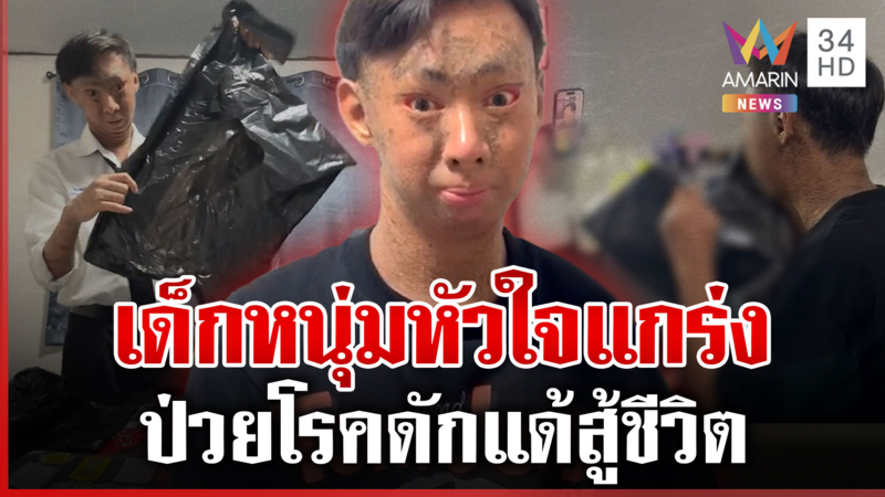 เปิดใจ "น้องยูฟ่า" ป่วยโรคดักแด้สู้ชีวิต ไม่ย่อท้อหาเงินส่งตัวเองเรียน