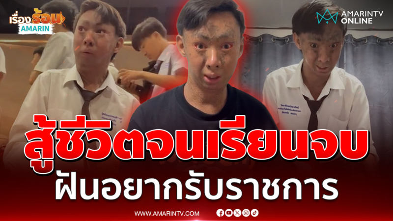 ไม่ย่อท้อ "น้องยูฟ่า" ป่วยโรคดักแด้ สู้ชีวิตจนเรียนจบ ฝันอยากรับราชการ