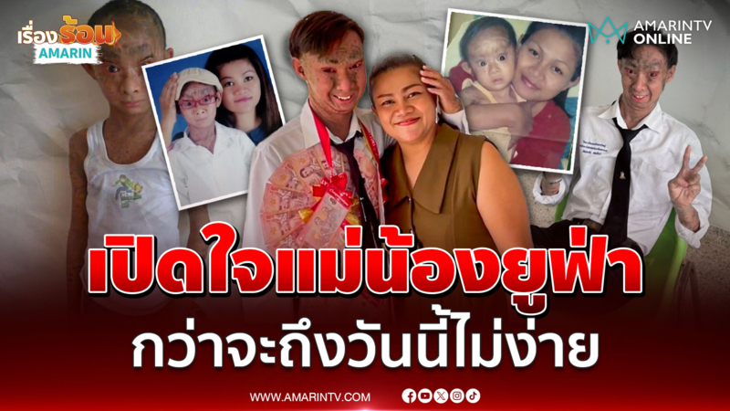เปิดใจแม่ กำลังใจสำคัญของ "น้องยูฟ่า" หนุ่มป่วยโรคดักแด้