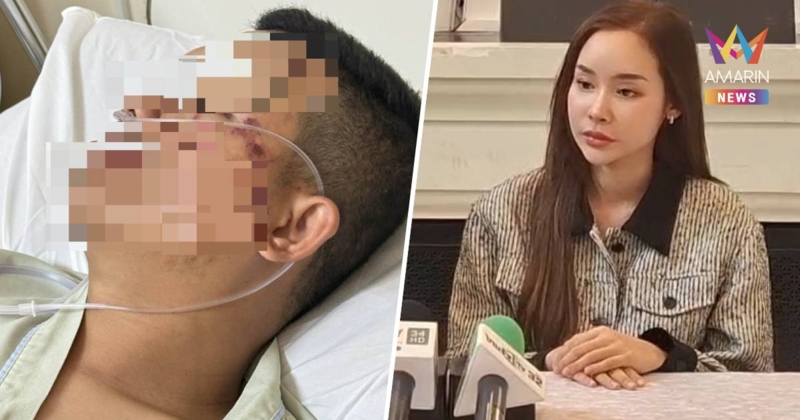 สลดจ่าอากาศถูกรุมยับ 3 ต่อ 1 กรามฉีก-ตาฉีก