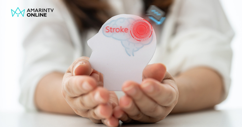 1 นาที สูญเสีย 1 ล้านเซลล์สมอง สโตรก โรคร้ายที่ต้องแข่งกับเวลา