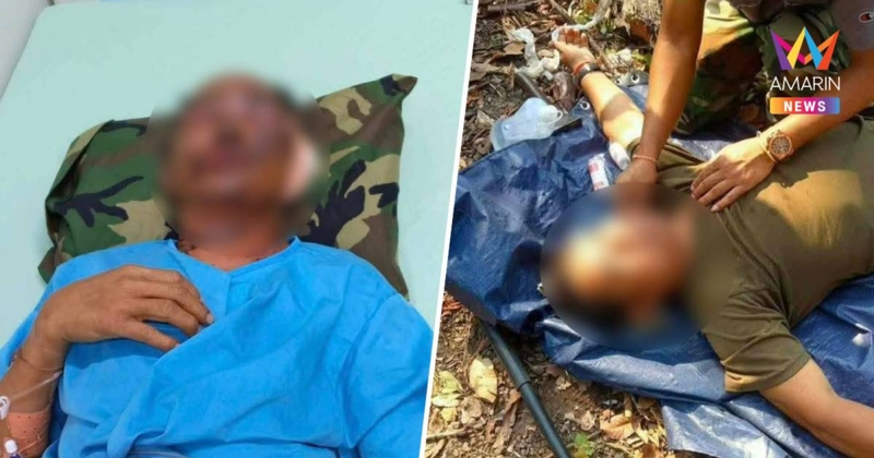 บึ้มสนั่นชายแดน! ทหารเขมรขุดคูเลต"พนมตะงอล"พลาดเจอระเบิดเก่าเจ็บ3นาย