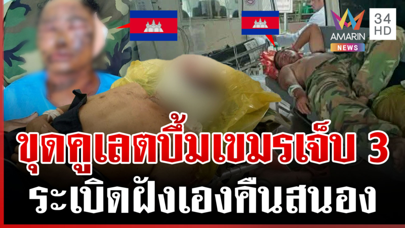 บึ้มสนั่นชายแดน เขมรขุดคูเลตกะรบไทย เจอระเบิดเก่าบึ้มบาดเจ็บสาหัส 