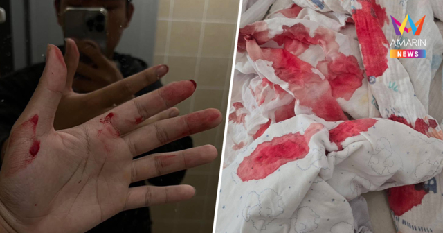 เหนืออ่วมหนัก กำเดาไหลพรากสังเวยอากาศพิษ รัฐบอกยังอยู่ในเกณฑ์รับได้