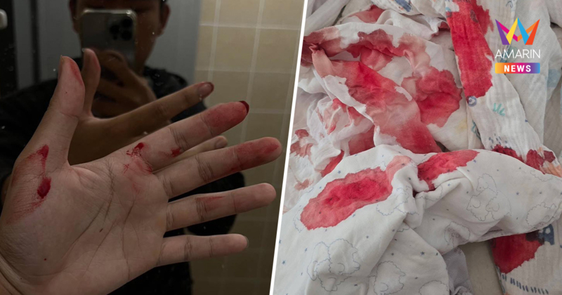 เหนืออ่วมหนัก กำเดาไหลพรากสังเวยอากาศพิษ รัฐบอกยังอยู่ในเกณฑ์รับได้