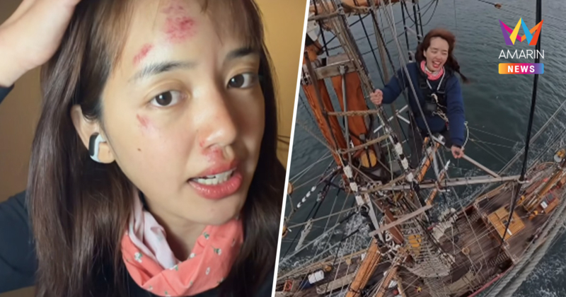 ช็อก "Pigkaploy" เผยเหตุ มีรอยช้ำเต็มหน้า ขณะเที่ยวทริปสุดขั้วโลก