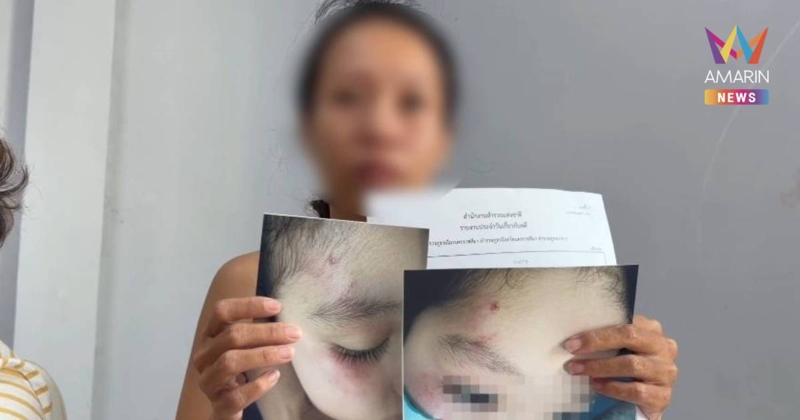 แม่ร้อง "มูลนิธิเป็นหนึ่ง" ลูกครึ่ง 8 ขวบถูกครูใช้ไม้กวาดตีหน้ายับ