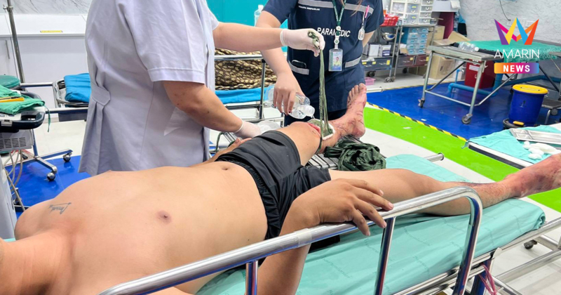 สนามรบเก่ายังหลอน! สิบเอกหัวหน้าชุดยิง เหยียบ "ขวากไม้ไผ่กัมพูชา"