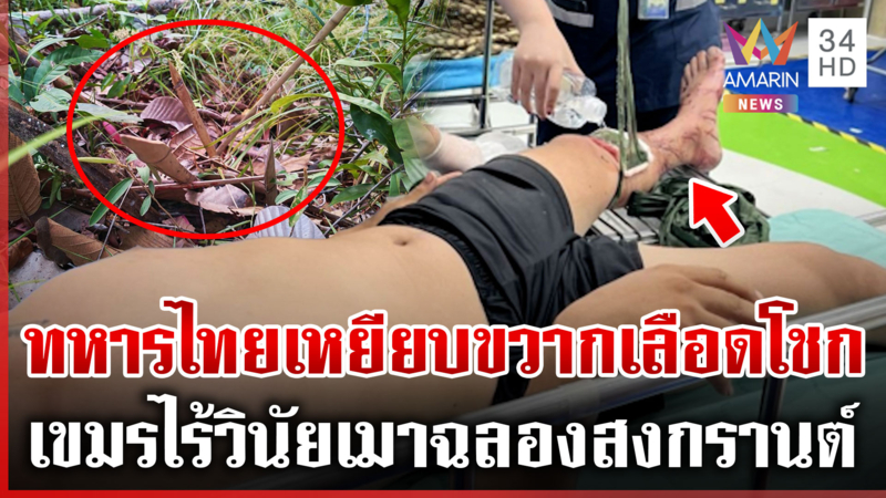 ทหารไทยเหยียบขวากขาซ้ายเจ็บ แฉเขมรเมาฉลองสงกรานต์คาฐาน