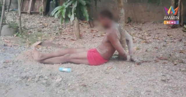 จ่อแจ้งข้อหาหนัก กำนันโหด ปมทารุณหนุ่ม ขยี้รังมดแดงใส่หัว 4 ชม.