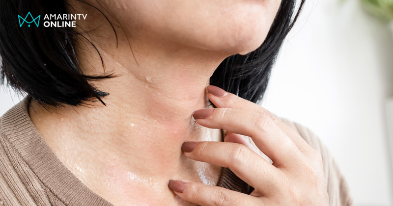 "ตัวร้อนแต่ไม่มีเหงื่อ" สัญญาณอันตราย ฮีทสโตรก