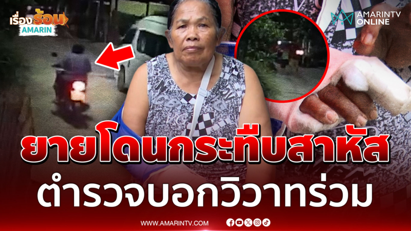 รับเคราะห์แทนแฝดน้อง! ยายโดนกระทืบสาหัส อึ้งตำรวจบอกวิวาทร่วม