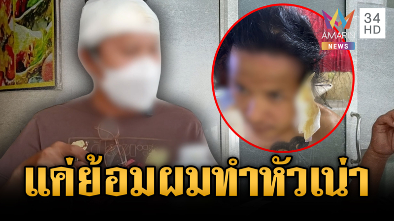 สยอง! ซื้อยาย้อมผมออนไลน์ แค่ 5 นาทีทำหัวเน่า