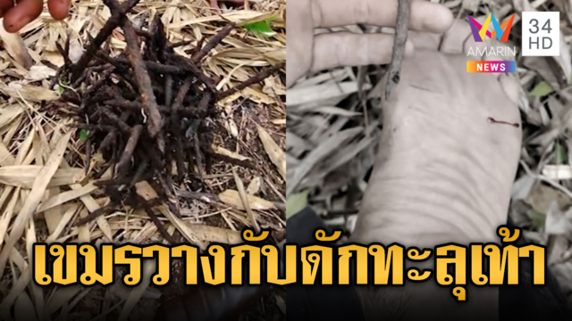 ทหารพรานไทยเหยียบกับดักเขมรทะลุเท้า