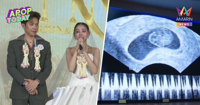 เซอร์ไพรส์ใหญ่ “นุ่น ดำดง - นุ กฤษดา” ประกาศข่าวดีมีเบบี๋กลางงานแต่ง