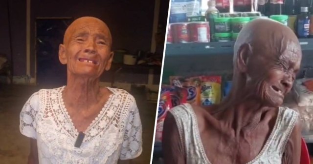 ยายวัย 76 ป่วยมะเร็งโกนหัว สแกนหน้าบัตรคนจนไม่ผ่าน 20 ครั้งปล่อยโฮ