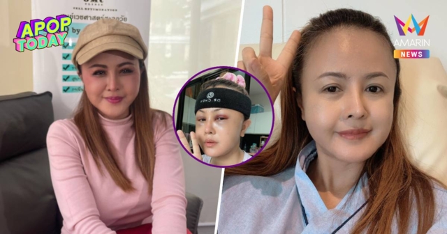 “ลำยอง หนองหินห่าว” แจงหน้าใหม่ทำฟรี! แฉอดีตพิษหมอกระเป๋าทำหน้าพัง
