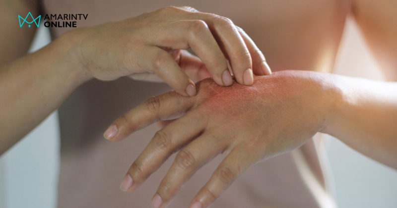 มือชาตำแหน่งต่างกัน บอกโรคอะไรได้บ้าง ?