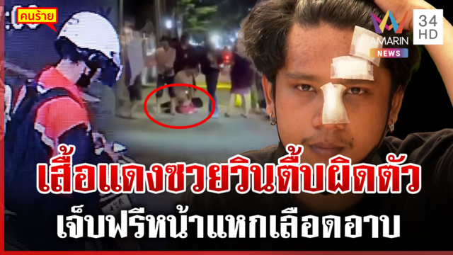 เจ็บตัวฟรี! จับขโมยผิดตัว-ตื้บหน้าแหก เปิดวงจรปิดดูชัดๆ พากันทยอยหนี