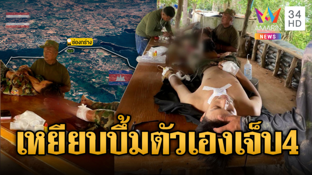 สิงโตทองคะนองไม่ออก เหยียบบึ้มเจ็บ4