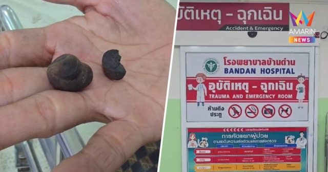 เตือนสายเห็ด! หามสามีภรรยาส่งโรงพยาบาล มีอาการอาเจียน หลังกินเห็ดในป่า