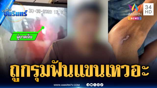 ร้องเรียนถูกรุมฟันแขนเหวอะ แต่คดีไม่คืบหน้า