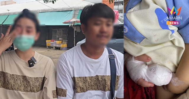 แม่น้องยูฟ่าเปิดใจ นาทีผู้ช่วยพยาบาลใช้กรรไกรพลาดโดนนิ้วลูก ไร้คำขอโทษ