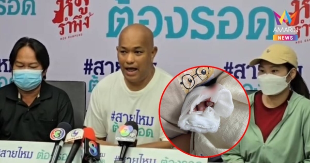 ครอบครัว น้องยูฟ่า จี้ สธ. สอบมาตรฐานหลังหลาน 1 ขวบถูกตัดนิ้วขาด
