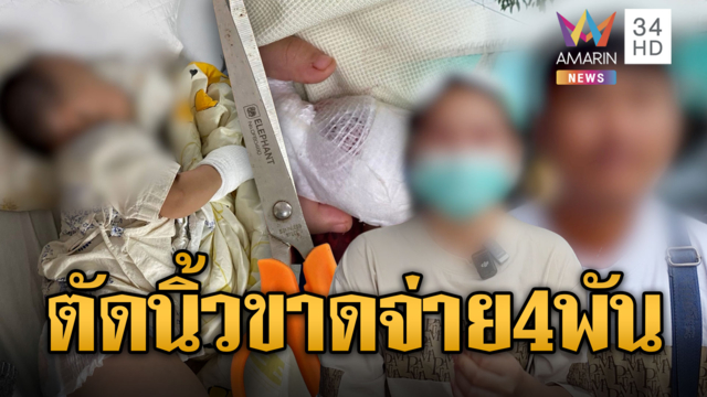 แม่ช็อก! ผช.พยาบาลชุ่ย ตัดนิ้วลูก 1 ขวบ เยียวยา 4 พัน
