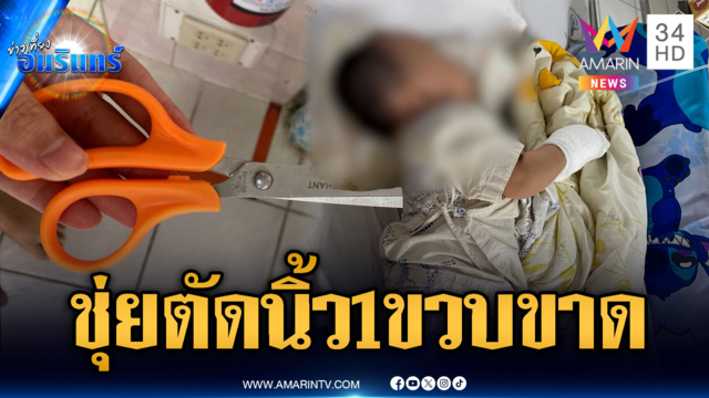 ผู้ช่วยพยาบาลชุ่ย ตัดนิ้ว 1 ขวบขาด จ่าย 4 พันไร้คำขอโทษ
