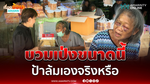 ชาวเน็ตแห่สงสัย ใครทำร้ายยายขายของตาบวม 