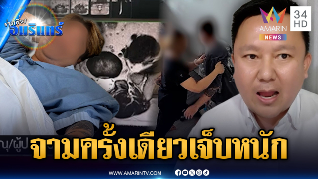 อุทาหรณ์จามแรงๆ ครั้งเดียว หมอนรองกระดูกปริ