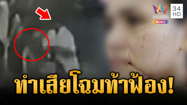 ฉุนสาวไม่ชนแก้ว ทำร้ายเสียโฉม ท้าฟ้องถ้าอยากได้ค่าเสียหาย