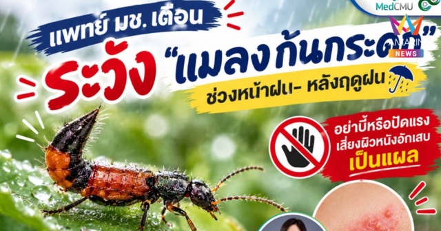 แพทย์ มช. เตือนระวัง 