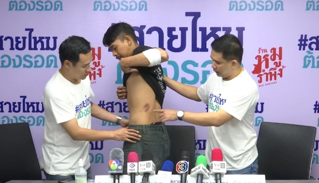 เจ็บทั้งตัว! หนุ่มไรเดอร์ ถูกเก๋งคลั่งไล่ชนกลางถนน