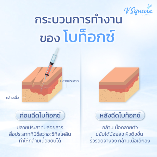 การทำงานโบท็อก