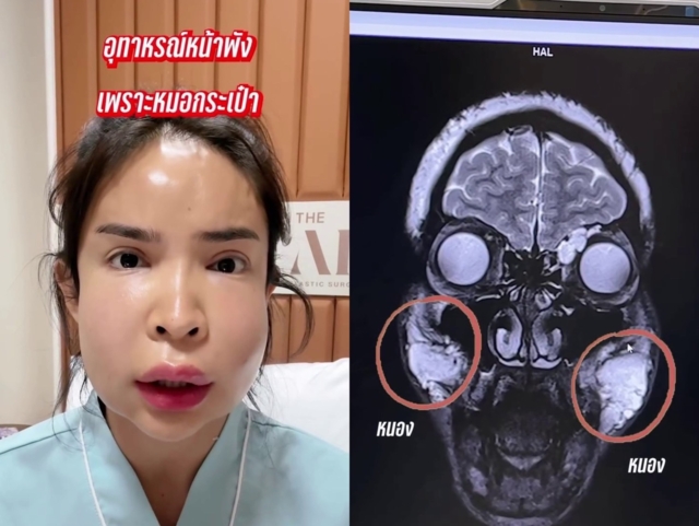นัท นิสามณี ขอบคุณภาพจากเฟซบุ๊ก สะบัดแปรง 