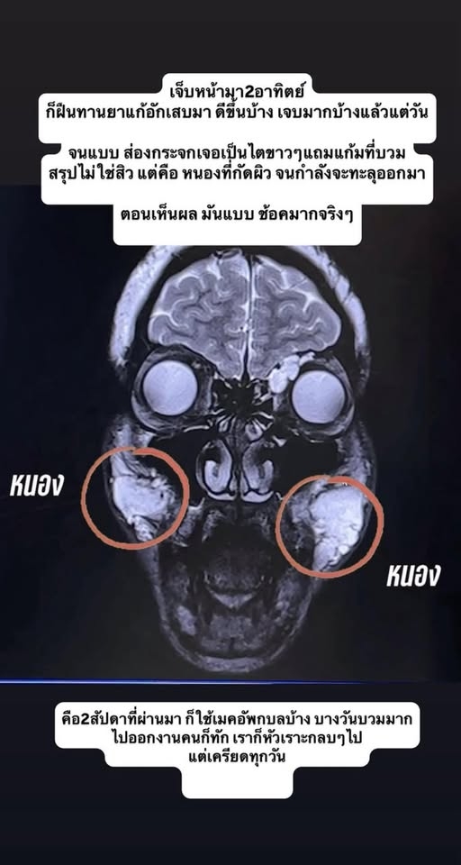 ภาพสแกนของนัท นิสามณี ขอบคุณภาพจากเฟซบุ๊ก สะบัดแปรง 