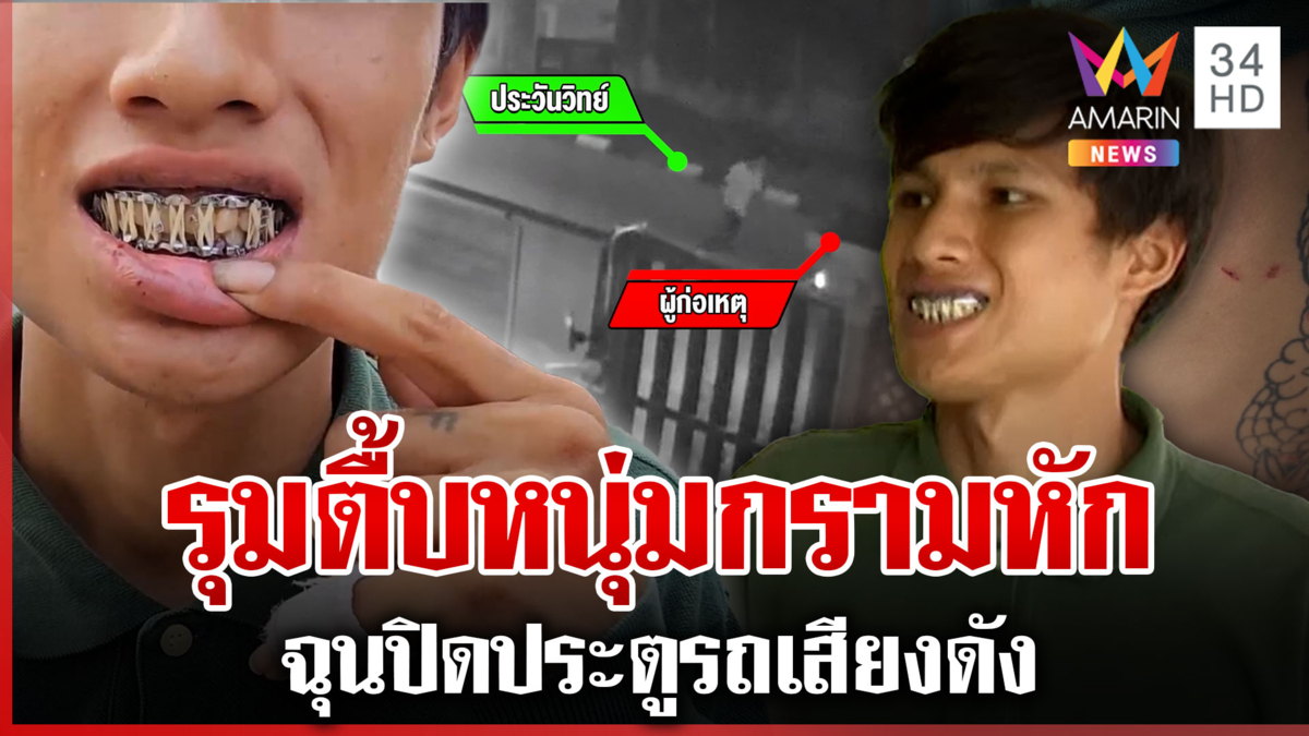 ฉุนปิดรถเสียงดัง! เจ้าถิ่นรุมตื้บหนุ่มกรามหัก ต้องกินอาหารผ่านสายยาง