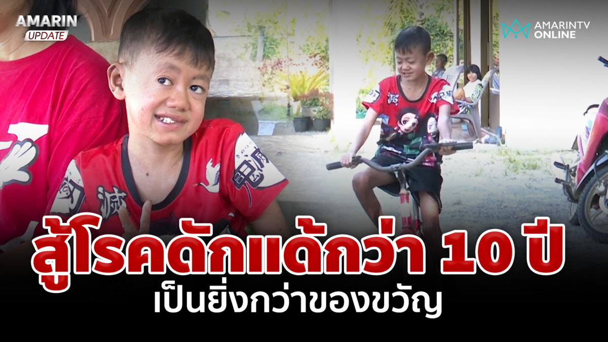 เปิดชีวิต "น้องภัทร" สู้โรคดักแด้ จากเคยใจสลายวันนี้ยิ่งกว่าปาฏิหาริย์