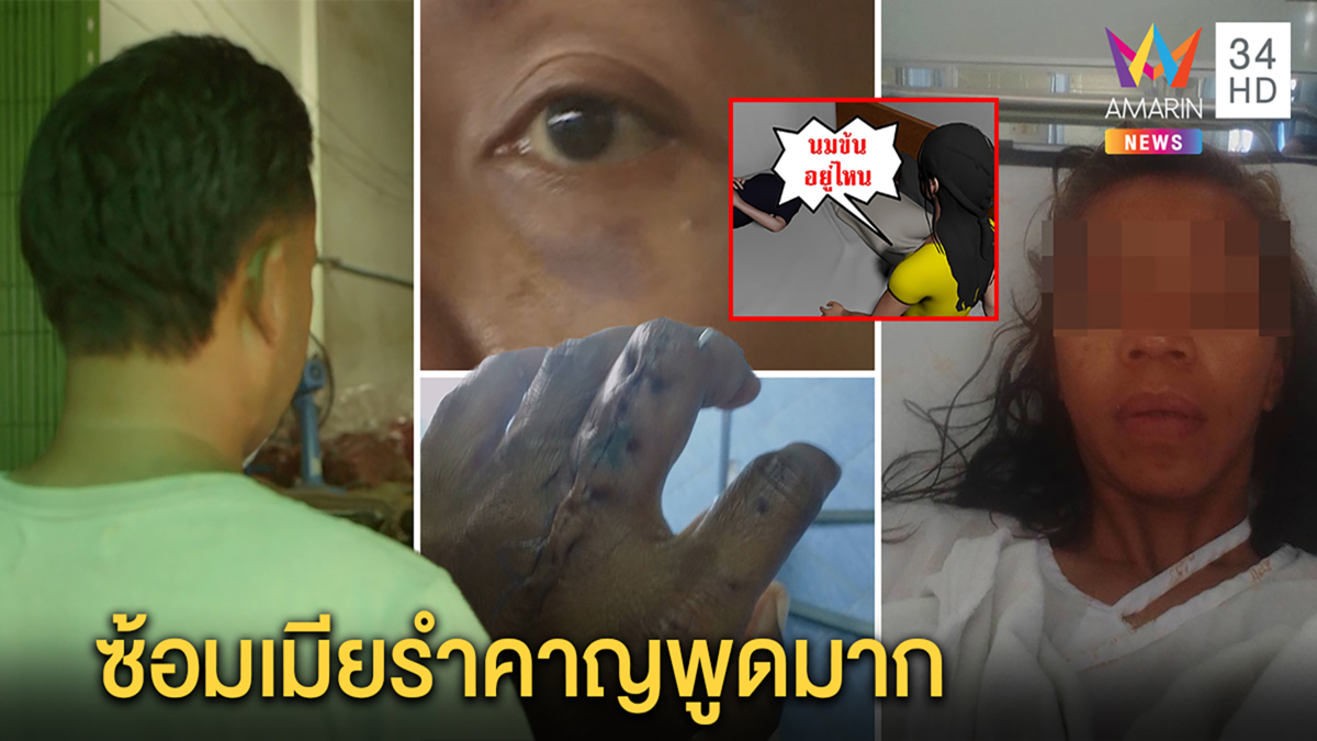 เหลือเชื่อ! เมียพูดมากถูกผัวซ้อมน่วมนิ้วหัก เจ้าตัวแฉหลอน พล่ามน่ารำคาญ