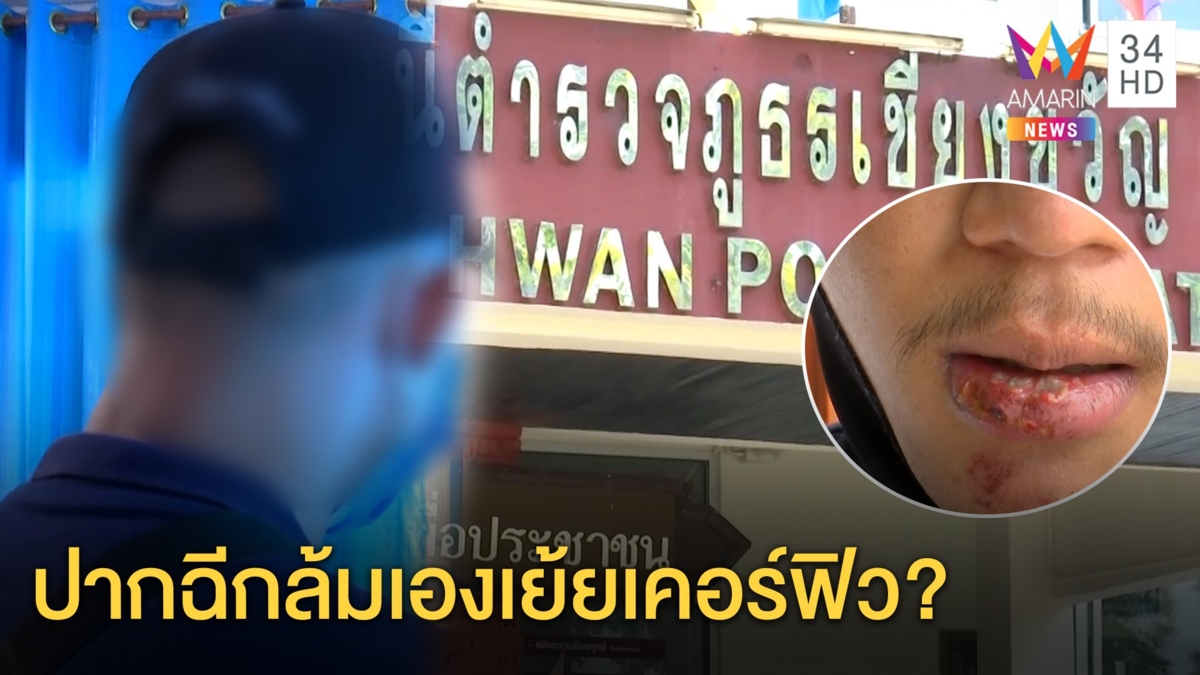 หนุ่มโชว์แผลถูกตำรวจไล่ต้อน ยิงขู่เตะปากฉีก ตำรวจโต้ แฉกลับฝ่าเคอร์ฟิวซิ่งล้มเอง