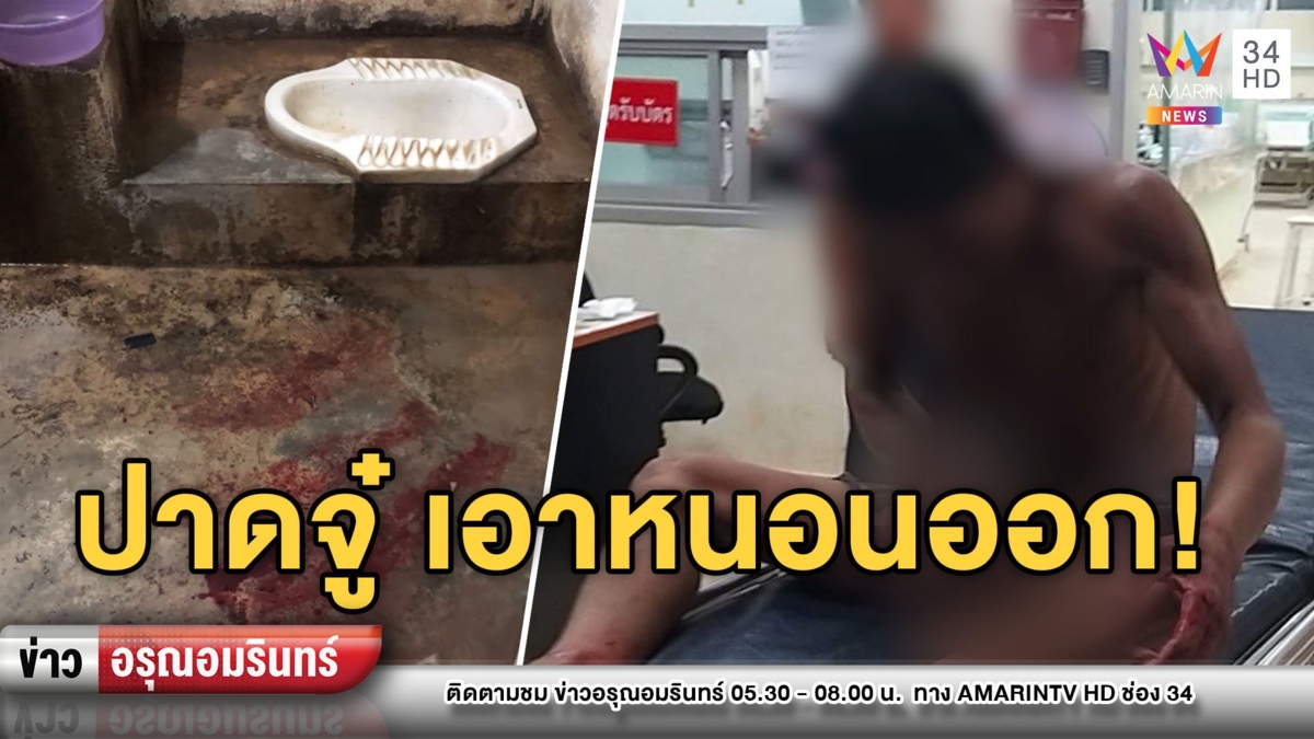 อึ้ง! หนุ่มคลั่งเห็น “หนอน”ออกจากอวัยวะเพศ คว้ามีดปาดเลือดสาด