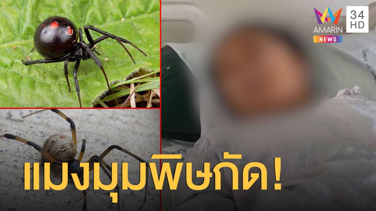 หญิงถูกแมงมุมแม่ม่ายกัด อาหารสาหัส ยังไม่ฟื้น
