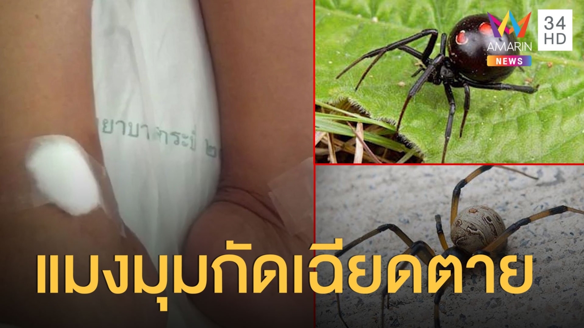 สุดช็อก! สาวถูกแมงมุมกัด พิษแรงทำหัวใจหยุดเต้น 4 รอบ