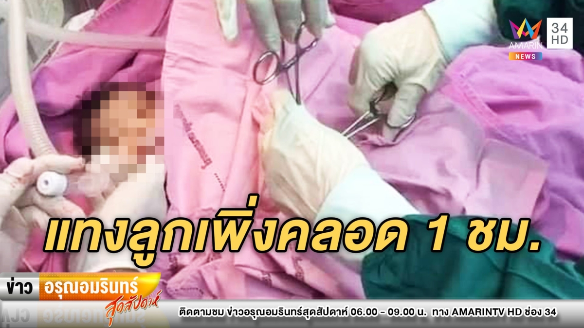 สะเทือนใจ! แม่วัยใสอายุ 15 ใช้กรรไกรแทงลูกเพิ่งคลอด 1 ชั่วโมง