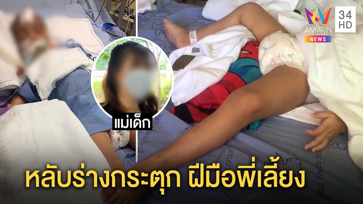 แฉพี่เลี้ยงโหดจับเด็ก 3 ขวบโขกผนังฉุนแค่ฉี่ราด แม่ใจสลายร่ำไห้เผยภาพลูกโคม่า
