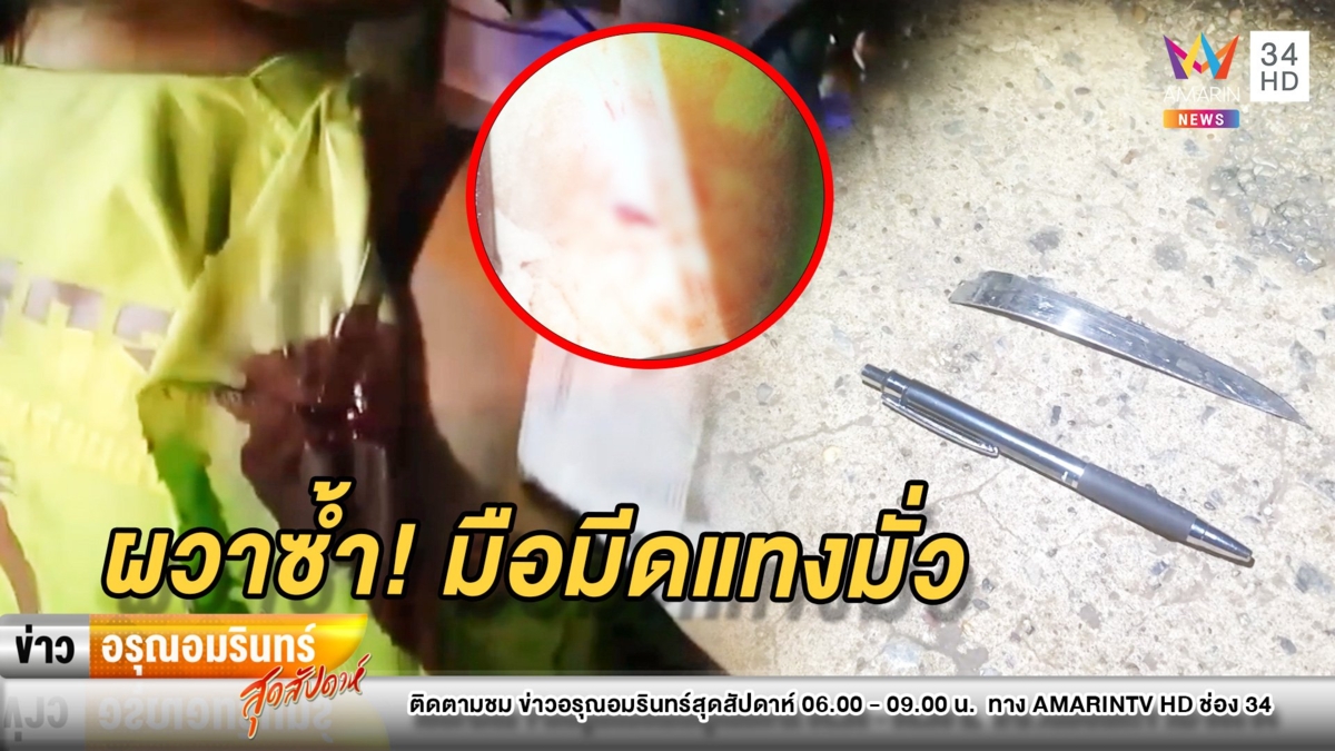 ผวาอีกรอบ! คนร้ายคว้ามีดกรีดสาวส่งอาหารบาดเจ็บ – ตร.เร่งล่า